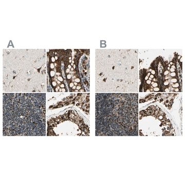 Anti-ME2 antibody produced in rabbit Prestige Antibodies&#174; Powered by Atlas Antibodies, affinity isolated antibody, buffered aqueous glycerol solution