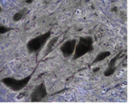 Anti-Tryptophan hydroxylase 2 Antibody from rabbit, purified by affinity chromatography