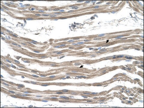 Anti-SLC25A22 antibody produced in rabbit IgG fraction of antiserum