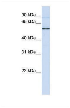 Anti-ESRRB antibody produced in rabbit affinity isolated antibody