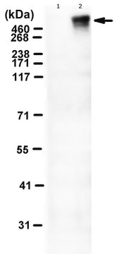 Anti-phospho RyR2 (Ser2808)