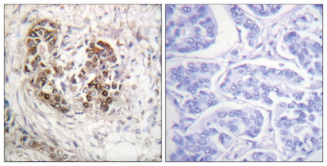 Anti-p53 antibody produced in rabbit affinity isolated antibody