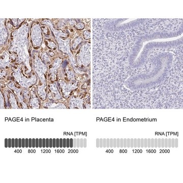 Anti-PAGE4 antibody produced in rabbit Prestige Antibodies&#174; Powered by Atlas Antibodies, affinity isolated antibody, buffered aqueous glycerol solution