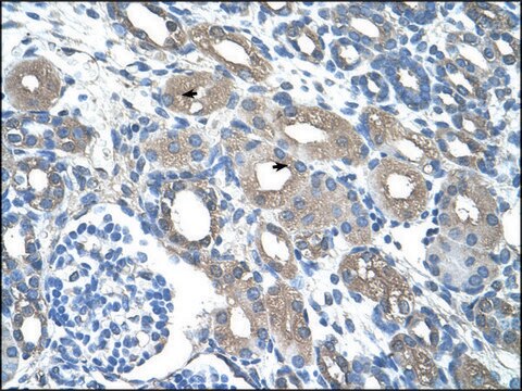 Anti-RSAD2 (AB2) antibody produced in rabbit IgG fraction of antiserum