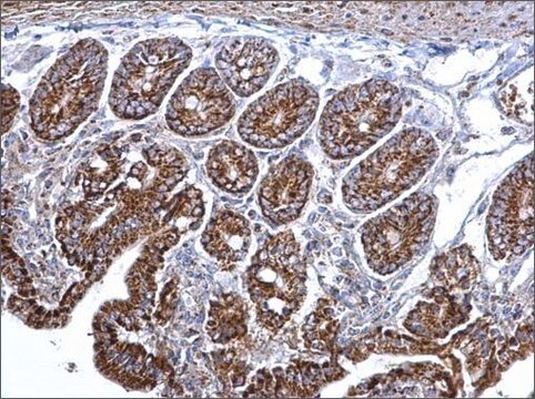 Anti-CS antibody produced in rabbit affinity isolated antibody, buffered aqueous solution