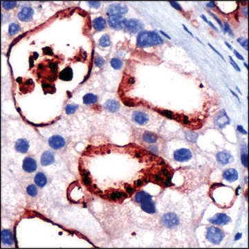 Anti-PSMA antibody, Rabbit monoclonal clone SP29, recombinant, expressed in proprietary host, tissue culture supernatant