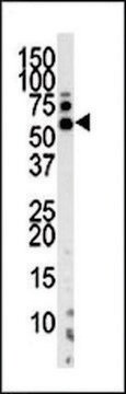 ANTI-PINK1 (PARK6) (N-TERM T133) antibody produced in rabbit purified immunoglobulin, buffered aqueous solution