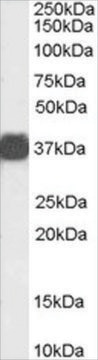 Anti-Arginase, Type 1/ARG1 (AB2) antibody produced in goat affinity isolated antibody, buffered aqueous solution