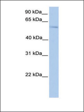 Anti-PLAG1 antibody produced in rabbit affinity isolated antibody