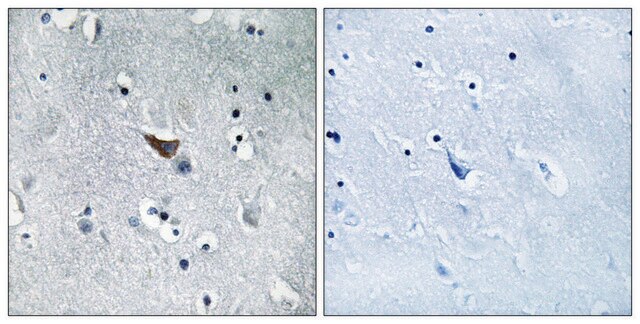 Anti-GLUR1 antibody produced in rabbit affinity isolated antibody