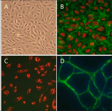 Human Umbilical Vein Endothelial Cells: HUVEC, neonatal