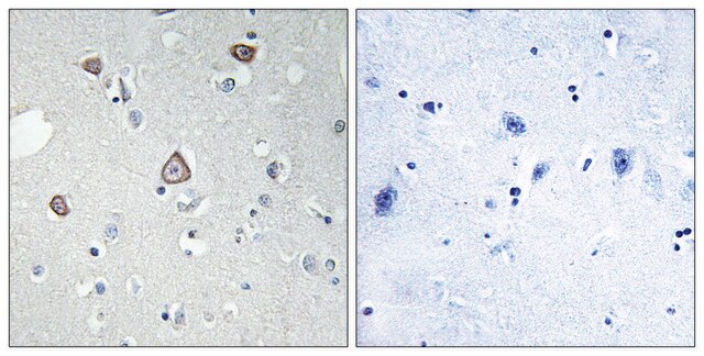 Anti-GRM2 antibody produced in rabbit affinity isolated antibody