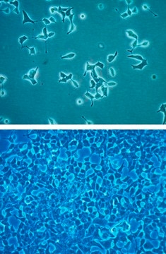 INS-1 832/13 Rat Insulinoma Cell Line INS-1 832/13 rat insulinoma cell line is a useful model for insulin secretion regulation and pancreatic islet beta-cell function studies.