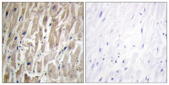 Anti-Cytochrome P450 2J2 antibody produced in rabbit affinity isolated antibody