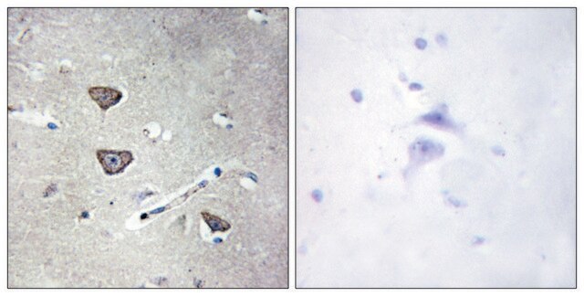 Anti-5-HT-2C antibody produced in rabbit affinity isolated antibody