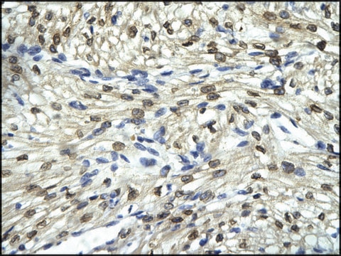 Anti-FLI1 antibody produced in rabbit affinity isolated antibody