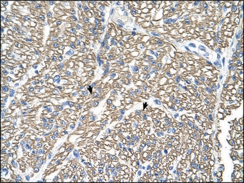 Anti-ATP1B1 antibody produced in rabbit affinity isolated antibody