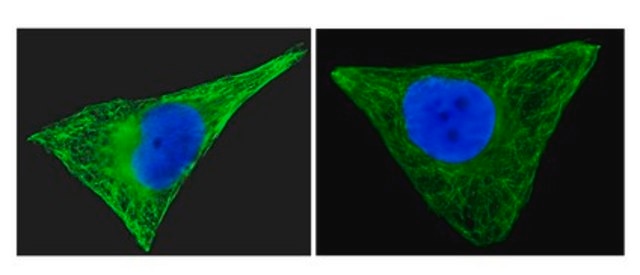 Anti-&#946;-Tubulin Antibody, clone AA2, Alexa Fluor&#8482; 488 conjugate clone AA2, Upstate&#174;, from mouse