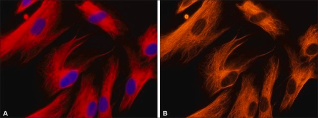 Monoclonal Anti-Vimentin&#8722;Cy3 antibody produced in mouse clone V9, purified immunoglobulin, buffered aqueous solution