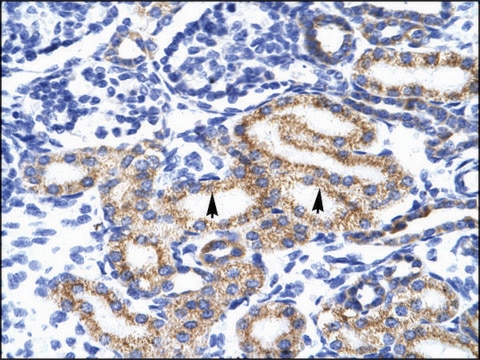 Anti-MEIS2 antibody produced in rabbit IgG fraction of antiserum