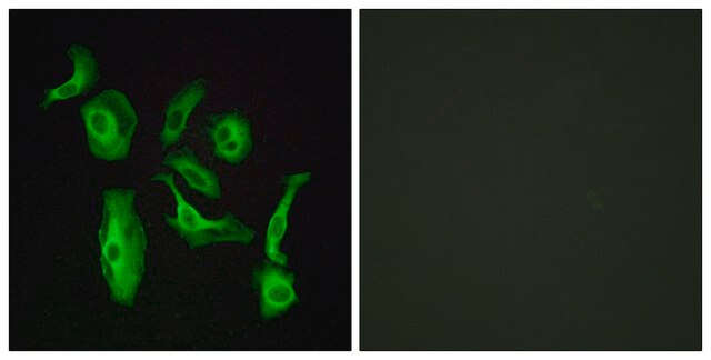 Anti-GPR133 antibody produced in rabbit affinity isolated antibody