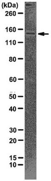 Anti-CTCF Antibody, clone 1.2.1.5.4 clone 1.2.1.5.4, from mouse