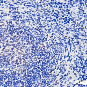 Anti-ATM antibody produced in rabbit