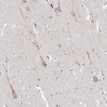 Anti-ASNS antibody produced in rabbit Prestige Antibodies&#174; Powered by Atlas Antibodies, affinity isolated antibody, buffered aqueous glycerol solution