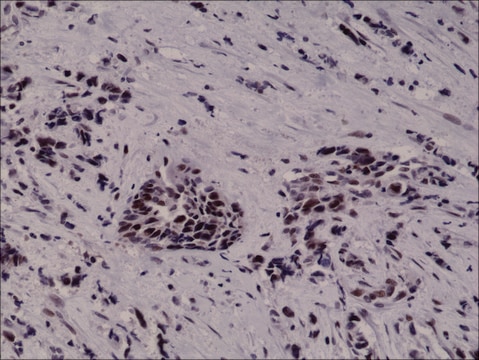 Anti-HIF-1 alpha antibody, Rabbit monoclonal recombinant, expressed in HEK 293 cells, clone RM242, purified immunoglobulin