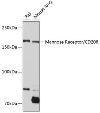 Anti-Mannose Receptor/CD206 antibody produced in rabbit