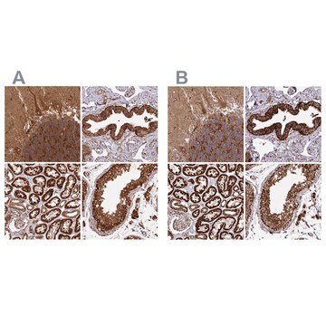 Anti-TRAP1 antibody produced in rabbit Prestige Antibodies&#174; Powered by Atlas Antibodies, affinity isolated antibody, buffered aqueous glycerol solution