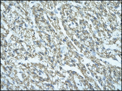 Anti-FGD1 antibody produced in rabbit affinity isolated antibody