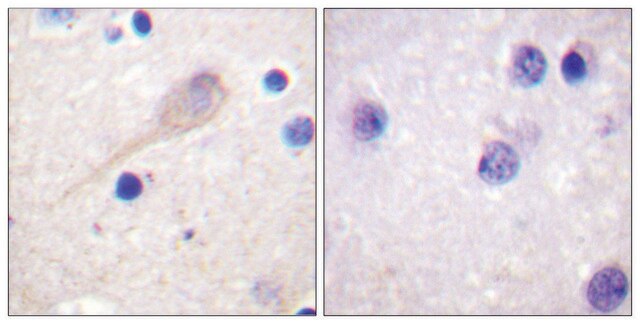 Anti-Parkin antibody produced in rabbit affinity isolated antibody