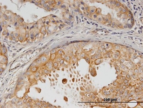 Monoclonal Anti-ERBB2 antibody produced in mouse clone 3B1, purified immunoglobulin, buffered aqueous solution