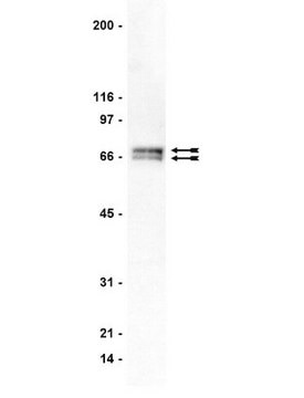 Anti-GRK 4-6 Antibody, clone A16/17 clone A16/17, Upstate&#174;, from mouse