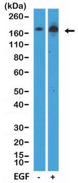 Anti-EGFR (phospho Y1068) Rabbit Monoclonal Antibody clone RM443, affinity purified immunoglobulin