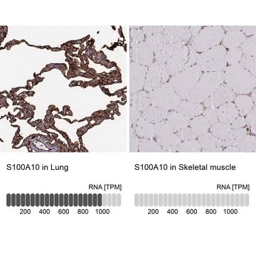 Anti-S100A10 antibody produced in rabbit Prestige Antibodies&#174; Powered by Atlas Antibodies, affinity isolated antibody, buffered aqueous glycerol solution