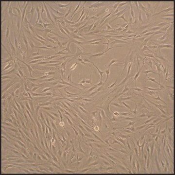 Human Fibroblast-Like Synoviocytes: HFLS, adult