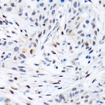 Anti-TFE3 antibody produced in rabbit