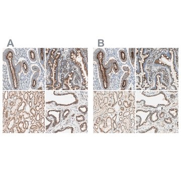 Anti-GOLGB1 antibody produced in rabbit Ab1, Prestige Antibodies&#174; Powered by Atlas Antibodies, affinity isolated antibody, buffered aqueous glycerol solution