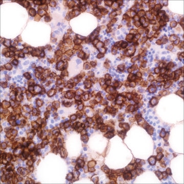 CD138 (EP201) Rabbit Monoclonal Primary Antibody