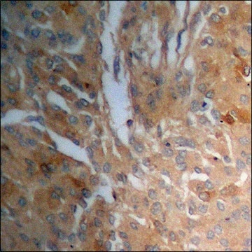 Anti-phospho-MYPT1 (pThr853) antibody produced in rabbit affinity isolated antibody