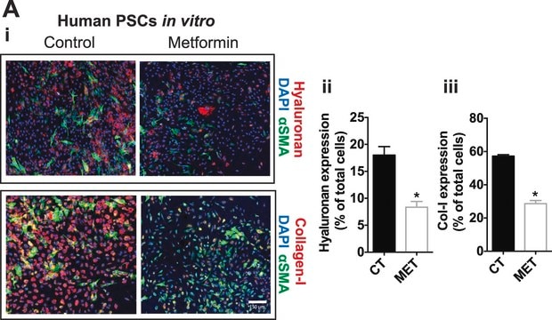 Anti-Actin, &#945;-Smooth Muscle - Cy3&#8482; antibody, Mouse monoclonal clone 1A4, purified from hybridoma cell culture