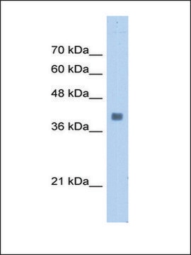 Anti-ALDOA antibody produced in rabbit IgG fraction of antiserum