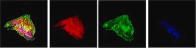 Anti-PCSK9 Antibody from rabbit, purified by affinity chromatography