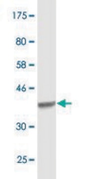 Monoclonal Anti-ACO1, (C-terminal) antibody produced in mouse clone 2F6, purified immunoglobulin, buffered aqueous solution