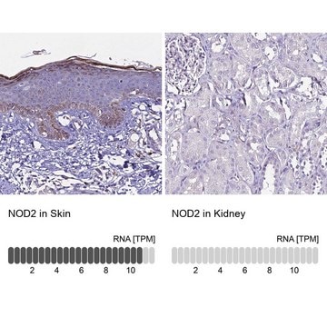 Anti-NOD2 antibody produced in rabbit Prestige Antibodies&#174; Powered by Atlas Antibodies, affinity isolated antibody, buffered aqueous glycerol solution