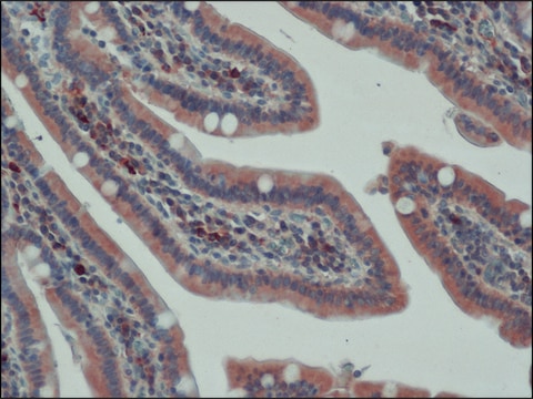 Anti-APC (C-terminal) antibody produced in rabbit ~1.0&#160;mg/mL, affinity isolated antibody