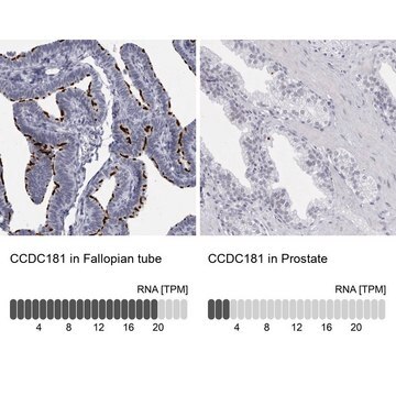 Anti-CCDC181 antibody produced in rabbit Prestige Antibodies&#174; Powered by Atlas Antibodies, affinity isolated antibody, buffered aqueous glycerol solution, ab4