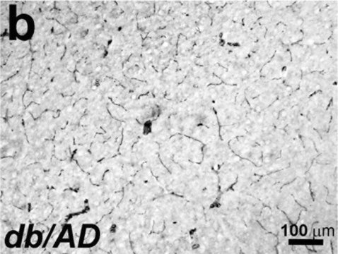 Anti-Actin, &#945;-Smooth Muscle antibody, Mouse monoclonal clone 1A4, purified from hybridoma cell culture